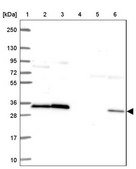 Anti-RPS3 antibody produced in rabbit Prestige Antibodies® Powered by Atlas Antibodies, affinity isolated antibody, buffered aqueous glycerol solution