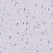 Anti-CD5 antibody produced in rabbit Prestige Antibodies® Powered by Atlas Antibodies, affinity isolated antibody, buffered aqueous glycerol solution