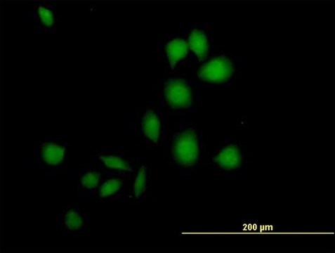 Anti-DSCR1 antibody produced in mouse purified immunoglobulin, buffered aqueous solution