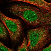 Anti-HGH1 antibody produced in rabbit Prestige Antibodies® Powered by Atlas Antibodies, affinity isolated antibody, buffered aqueous glycerol solution