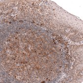 Monoclonal Anti-Tmem123 Antibody Produced In Mouse Prestige Antibodies® Powered by Atlas Antibodies, clone CL14381, affinity isolated antibody, buffered aqueous glycerol solution