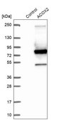 Anti-ACOX2 antibody produced in rabbit Prestige Antibodies® Powered by Atlas Antibodies, affinity isolated antibody, buffered aqueous glycerol solution