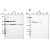 Anti-CARS antibody produced in rabbit Prestige Antibodies® Powered by Atlas Antibodies, affinity isolated antibody, buffered aqueous glycerol solution