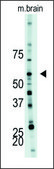 Anti-PFKFB4 (center) antibody produced in rabbit IgG fraction of antiserum, buffered aqueous solution