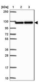 Anti-SYNE3 antibody produced in rabbit Prestige Antibodies® Powered by Atlas Antibodies, affinity isolated antibody, buffered aqueous glycerol solution