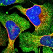 Anti-ZCCHC7 antibody produced in rabbit Prestige Antibodies® Powered by Atlas Antibodies, affinity isolated antibody, buffered aqueous glycerol solution, Ab1