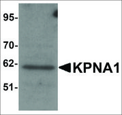 Anti-KPNA1 antibody produced in rabbit affinity isolated antibody, buffered aqueous solution