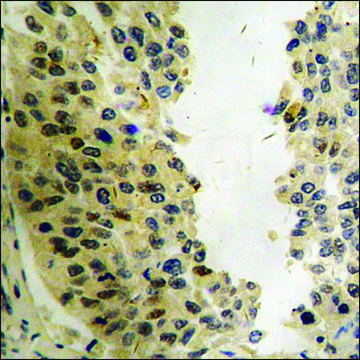 Anti-phospho-STK39 (pSer325) antibody produced in rabbit affinity isolated antibody