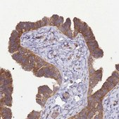 Anti-BECN1 antibody produced in rabbit Prestige Antibodies&#174; Powered by Atlas Antibodies, affinity isolated antibody, buffered aqueous glycerol solution