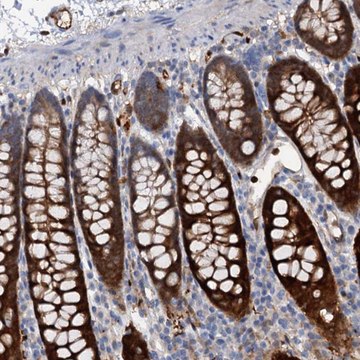 Anti-IL17RD antibody produced in rabbit Prestige Antibodies&#174; Powered by Atlas Antibodies, affinity isolated antibody, buffered aqueous glycerol solution