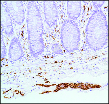 Anti-S100 Beta antibody, Rabbit monoclonal clone SP127, recombinant, expressed in proprietary host, affinity isolated antibody