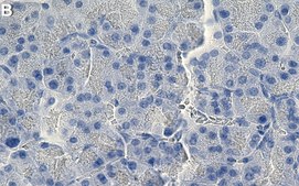 Anti-Glucagon Antibody, clone 13D11.33 ZooMAb® Mouse Monoclonal recombinant, expressed in HEK 293 cells