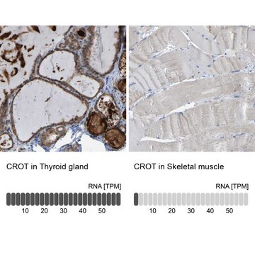 Anti-CROT antibody produced in rabbit Prestige Antibodies&#174; Powered by Atlas Antibodies, affinity isolated antibody, buffered aqueous glycerol solution, Ab2