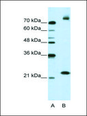 Anti-FZD9 antibody produced in rabbit IgG fraction of antiserum
