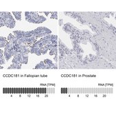 Anti-CCDC181 antibody produced in rabbit Prestige Antibodies® Powered by Atlas Antibodies, affinity isolated antibody, buffered aqueous glycerol solution, ab2