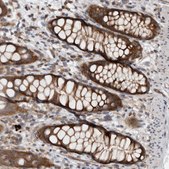 Anti-CCDC43 antibody produced in rabbit Prestige Antibodies® Powered by Atlas Antibodies, affinity isolated antibody, buffered aqueous glycerol solution
