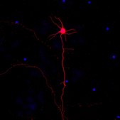 Neuro-Chrom Pan Neuronal Marker Antibody-Rabbit, Cy3 Conjugate Neuro-Chrom, from rabbit