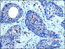 Anti-WISP2 affinity isolated antibody