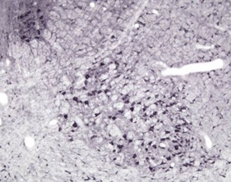 Anti-Nitric Oxide Synthase I Antibody Chemicon&#174;, from rabbit