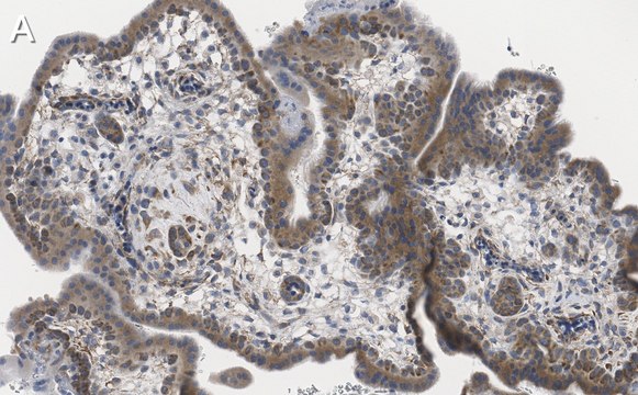 Anti-ZCCHC3 Antibody, clone 1E10 ZooMAb&#174; Rabbit Monoclonal recombinant, expressed in HEK 293 cells