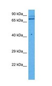 Anti-TGM2 (AB2) antibody produced in rabbit affinity isolated antibody