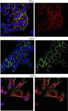 Anti-EEA1 Antibody from rabbit, purified by affinity chromatography