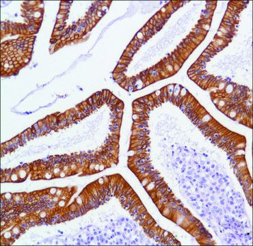 Anti-C-ERBB3 antibody, Rabbit monoclonal clone SP71, recombinant, expressed in proprietary host, affinity isolated antibody