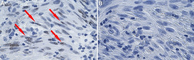 Anti-HHV-8 LNA-1 Antibody, clone 5L10 ZooMAb&#174; Rabbit Monoclonal recombinant, expressed in HEK 293 cells