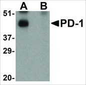 抗PD-1 (ab1) 兔抗 affinity isolated antibody, buffered aqueous solution