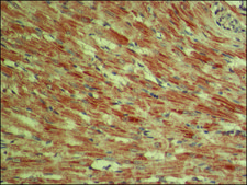 Anti-Tensin 1 antibody produced in rabbit ~1.0&#160;mg/mL, affinity isolated antibody