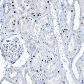 Anti-CAMTA1 antibody produced in rabbit Prestige Antibodies® Powered by Atlas Antibodies, affinity isolated antibody, buffered aqueous glycerol solution