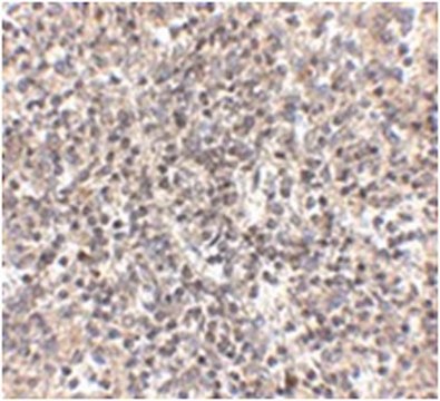 Anti-RSPO1 Antibody from rabbit, purified by affinity chromatography