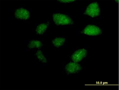 Anti-ZBTB32 antibody produced in mouse purified immunoglobulin, buffered aqueous solution