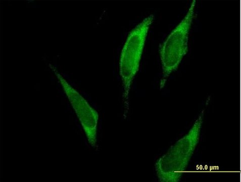 Anti-FARSA antibody produced in mouse purified immunoglobulin, buffered aqueous solution