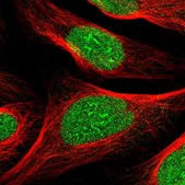 Anti-ZBTB43 antibody produced in rabbit Prestige Antibodies® Powered by Atlas Antibodies, affinity isolated antibody, buffered aqueous glycerol solution
