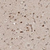 Anti-CAAP1 antibody produced in rabbit Prestige Antibodies® Powered by Atlas Antibodies, affinity isolated antibody, buffered aqueous glycerol solution, Ab2