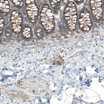 抗-LZTR1 兔抗 Prestige Antibodies&#174; Powered by Atlas Antibodies, affinity isolated antibody, buffered aqueous glycerol solution