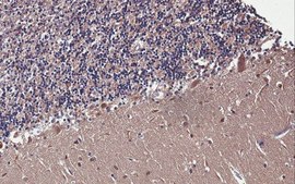 Anti-PRMT9 Antibody, clone 128-29-1 clone 128-29-1, from mouse