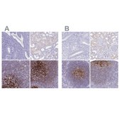 Anti-CR2 antibody produced in rabbit Prestige Antibodies® Powered by Atlas Antibodies, affinity isolated antibody, buffered aqueous glycerol solution