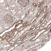 Anti-KLHL24 antibody produced in rabbit Prestige Antibodies® Powered by Atlas Antibodies, affinity isolated antibody, buffered aqueous glycerol solution