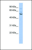 Anti-ETV1 antibody produced in rabbit affinity isolated antibody