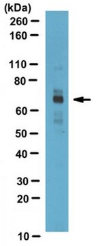 Anti-CPT2 Antibody serum, from rabbit