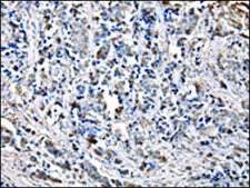 Anti-CHMP3 affinity isolated antibody