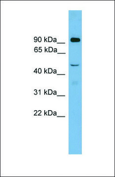 Anti-ZFY2 antibody produced in rabbit affinity isolated antibody