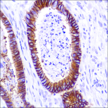 Anti-Cadherin -17 antibody, Rabbit monoclonal recombinant, expressed in proprietary host, clone SP183, affinity isolated antibody