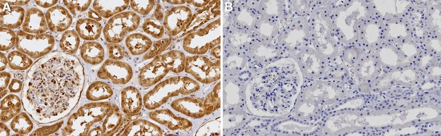 Anti-SDHD/CybS Antibody, clone 1F5-H2L2 ZooMAb&#174; Rabbit Monoclonal recombinant, expressed in HEK 293 cells