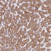 Anti-SGPP1 antibody produced in rabbit Prestige Antibodies® Powered by Atlas Antibodies, affinity isolated antibody, buffered aqueous glycerol solution