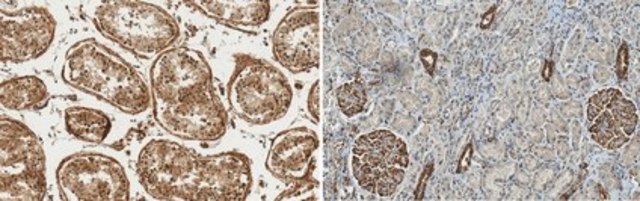 Anti-Wilms Tumor (WT33) from rabbit, purified by affinity chromatography