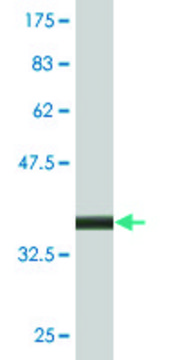 Monoclonal Anti-LAMP2 antibody produced in mouse clone 2G10, purified immunoglobulin, buffered aqueous solution