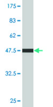 Monoclonal Anti-C4BPB antibody produced in mouse clone 1G9, purified immunoglobulin, buffered aqueous solution